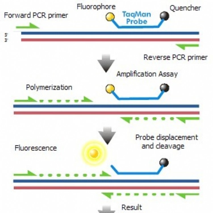 人白细胞抗原PCR试剂盒